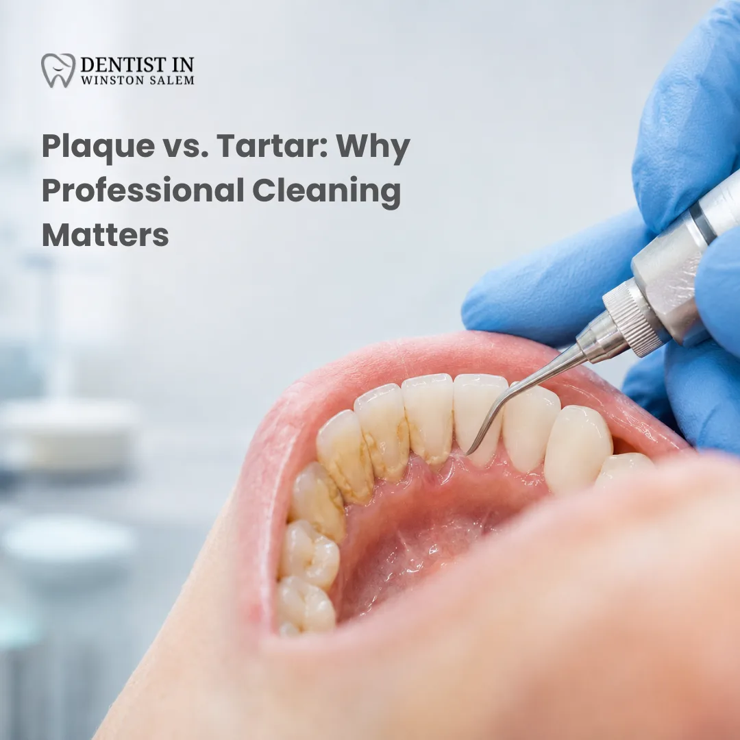 Plaque vs. Tartar: Why Professional Cleaning Matters