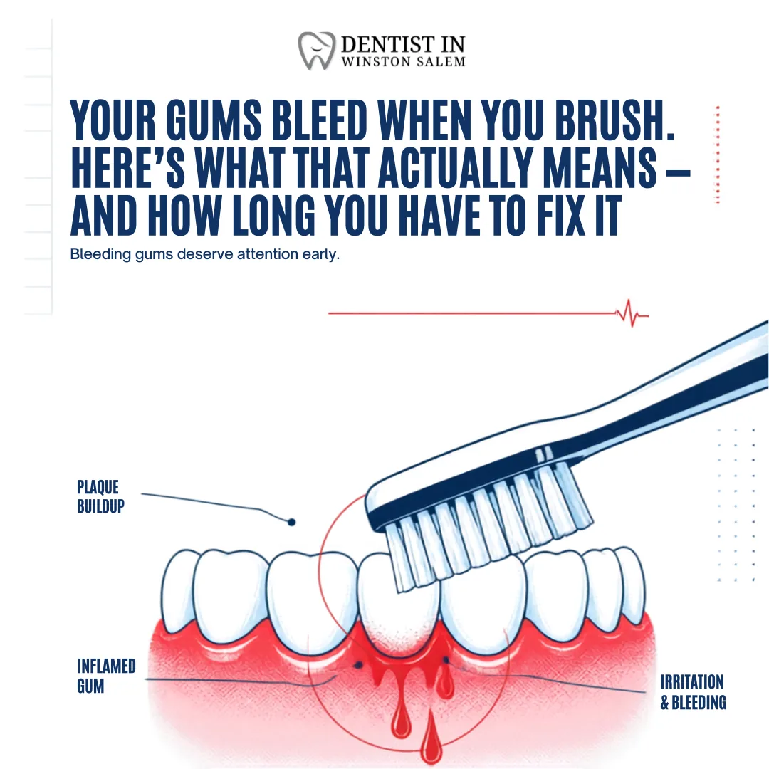 Your Gums Bleed When You Brush. Here's What That Actually Means — and How Long You Have to Fix It